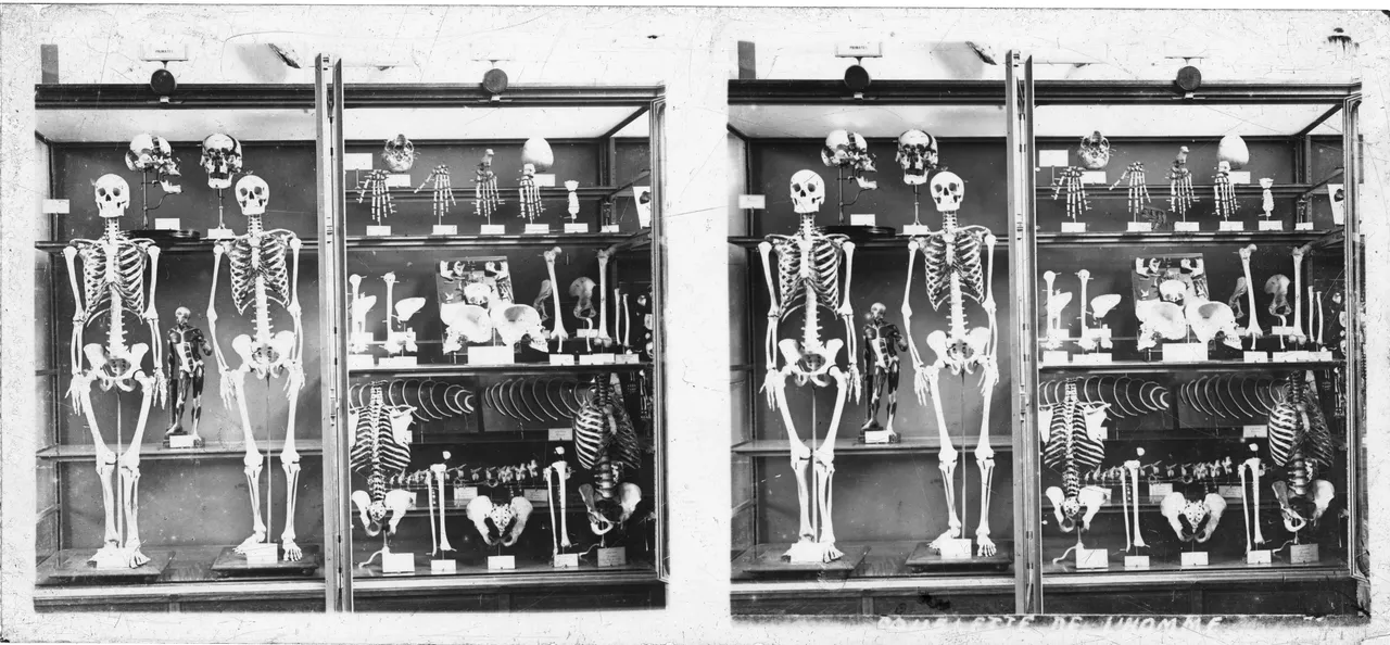 VitroPlaque9005.jpg