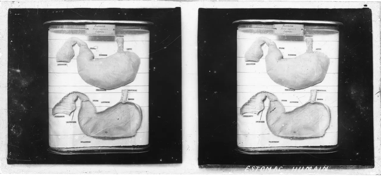 VitroPlaque9006.jpg