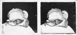 VitroPlaque9007.jpg